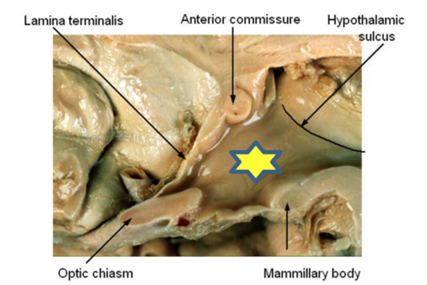 <p>anterior commissure along lamina terminalis to optic chiasm; central sulcus</p>