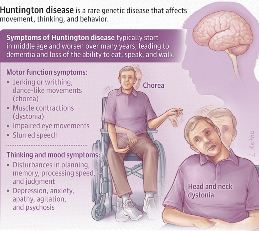 <p>-characterized by uncontrollable body movements and degeneration of the nervous system; usually fatal ~20 years after the onset of symptoms.<br><br>-fatigue (activity mod/breaks), incoordination and dec motor control (AE)<br>-difficulty with some cognition (word retrieval), problem solving skills</p><p>-early stages- difficulty maintaining work performance</p><p>-middle stages- difficulty with memory and decision making</p><p>-later stages- dysarthria makes speaking difficult</p><p>Evaluation: Unified Huntington’s Disease Rating Scale- assesses motor, cognitive, functional, and behavioral changes</p><p>-Intervention: should be compensatory</p><p>Early on mods should focus on activities that require fine motor skills (fastening zippers, buttons, hooks, etc.) since challenges are usually limited to fine motor coordination at the beginning </p>