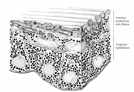 <p>anterior epithelium of the iris </p>