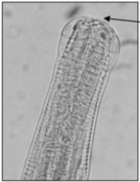 <p>What GIN is shown in this image</p><p>why</p><p>found where</p><p>symptoms of infection</p><p>ppp?</p>