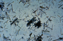 <p>Name this drug associated crystal? what is it associated with? </p>