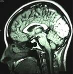 <p>which plane is shown here?</p>