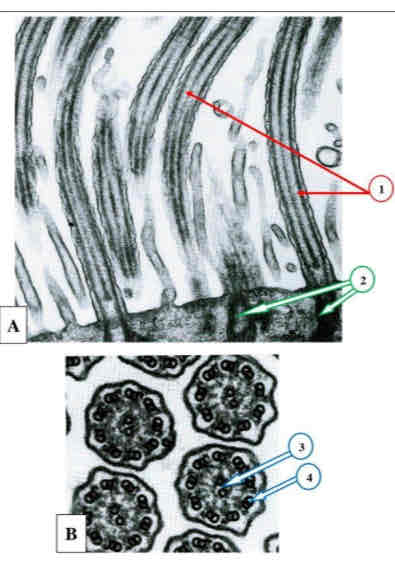 term image