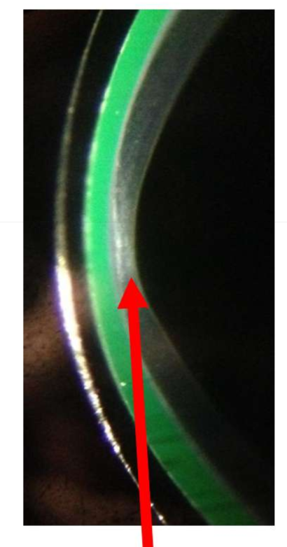 <p>Name the finding.</p>