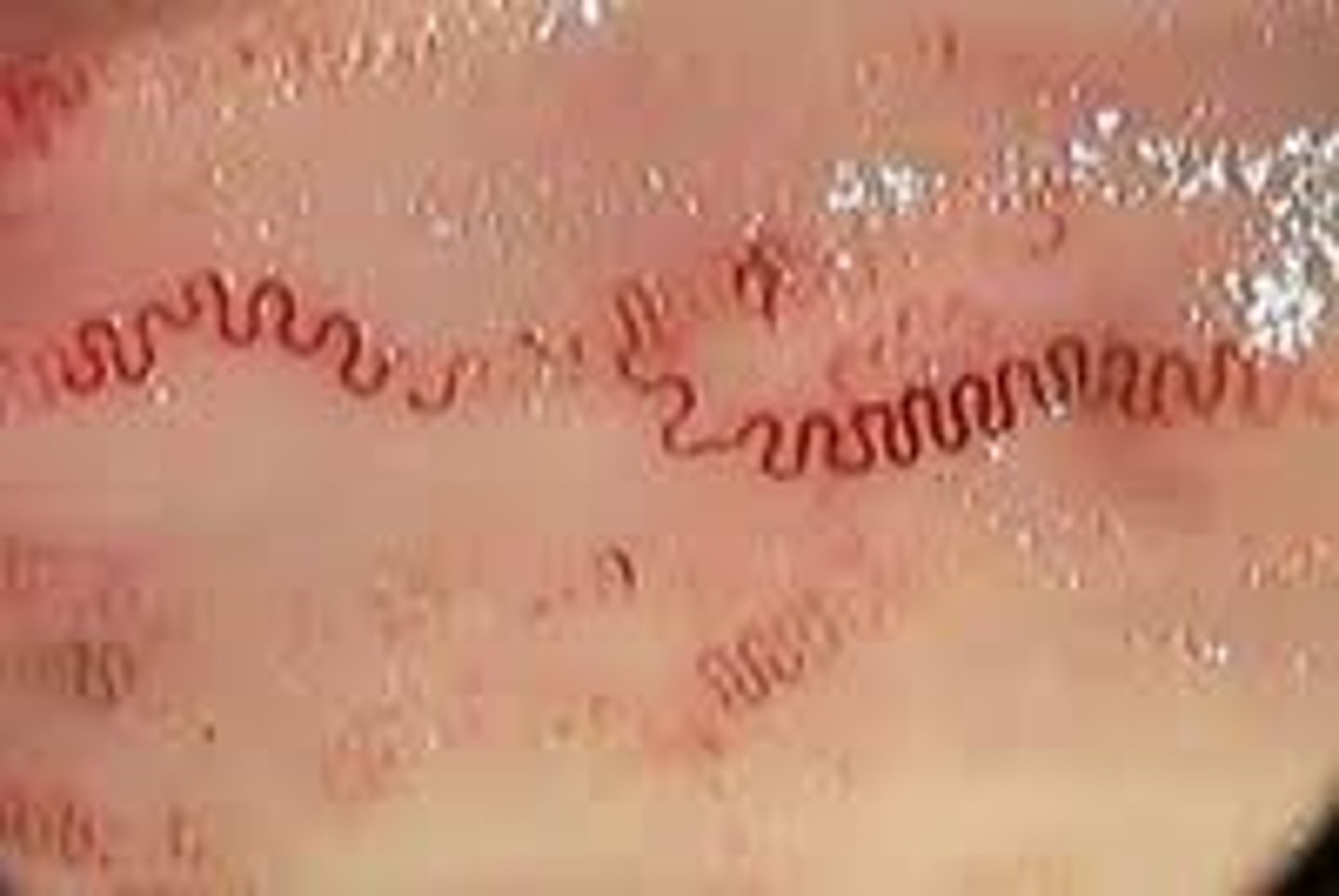 <p>esophageal worm of ruminants</p>