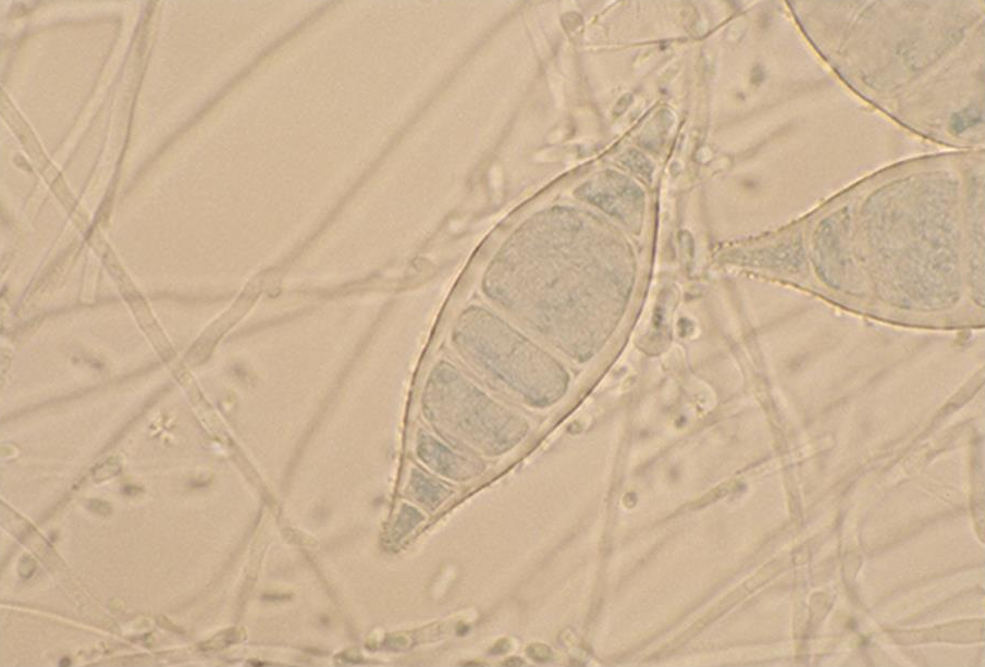 <p>Spindle shaped, with echinulate, thick walls. They measure 12 to 25 um and have 3 to 15 cells. The tapering, sometimes elongated, spiny distal ends are key features that distinguish this species. Colonies are fluffy and white, with the reverse side of the colony usually developing a lemon-yellow pigment, especially on potato dextrose agar. Worldwide distribution.</p>