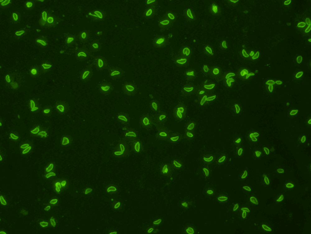 <p>Antibodies bind to the antigen and become visible under a microscope, indicating a positive test.</p>