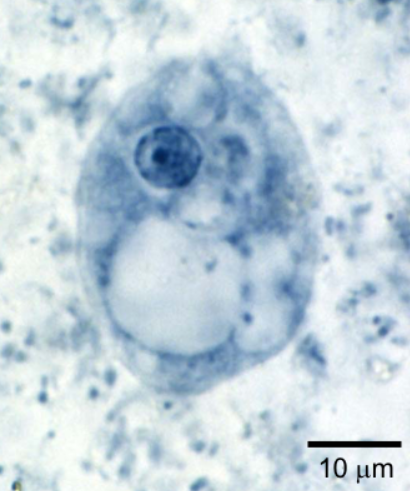 <p>Identify organism and stage</p>