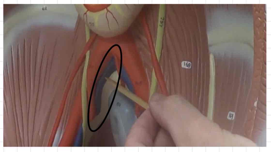 <p>what is this? (torso model)</p>