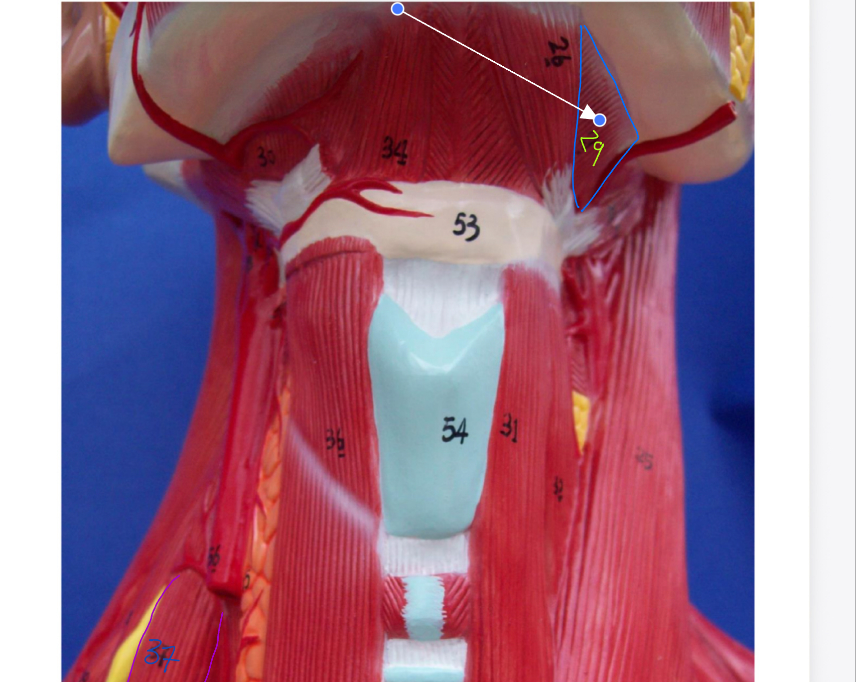<p>What type of muscle is this ( altay model)</p>