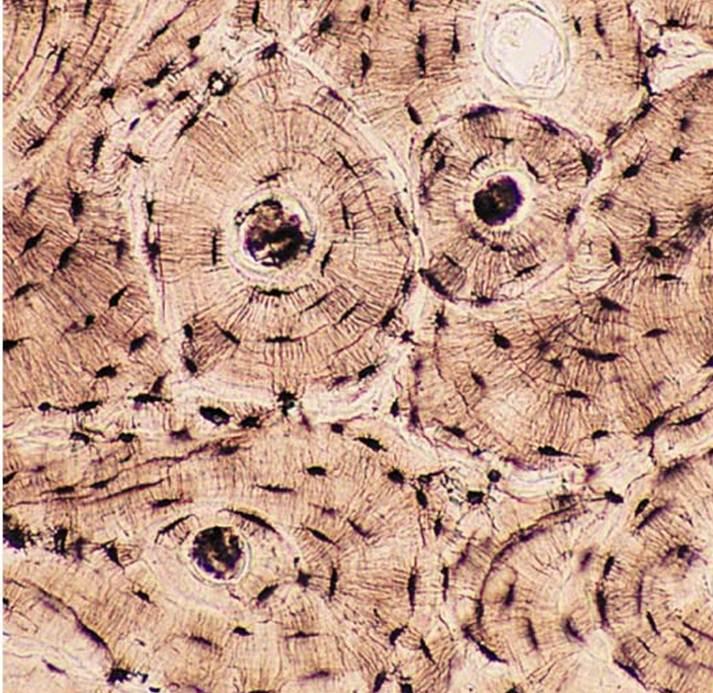 <p>what are the cells in bone tissue called?</p>
