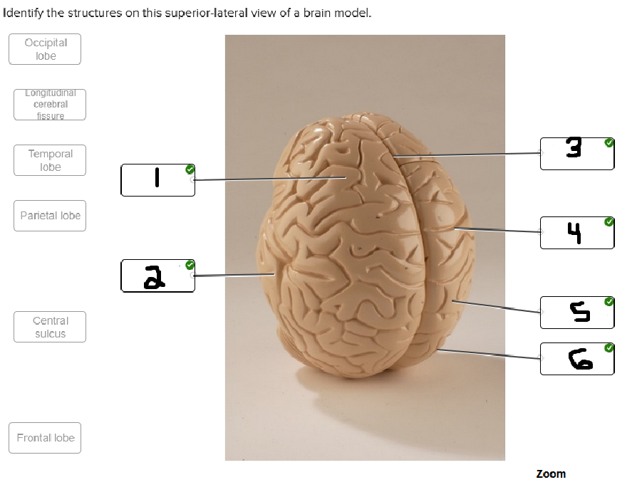 <p>whats labeled #1</p>