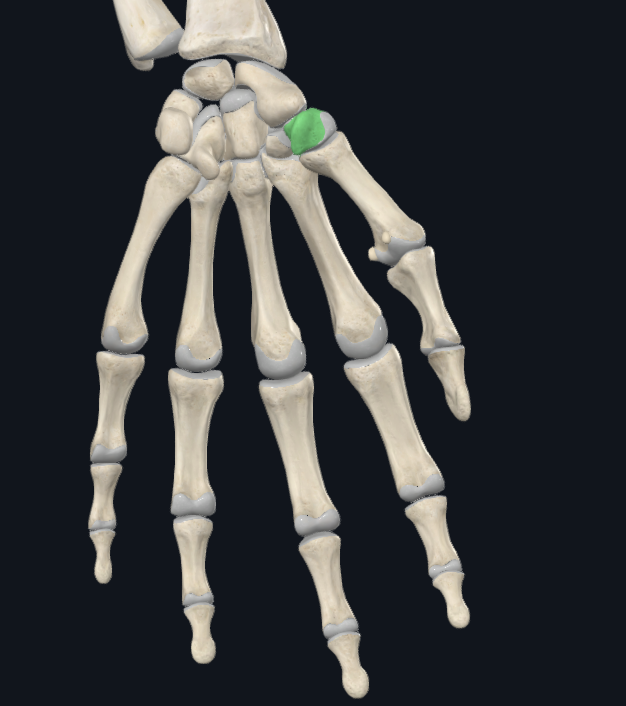 <p>What bone is this</p>