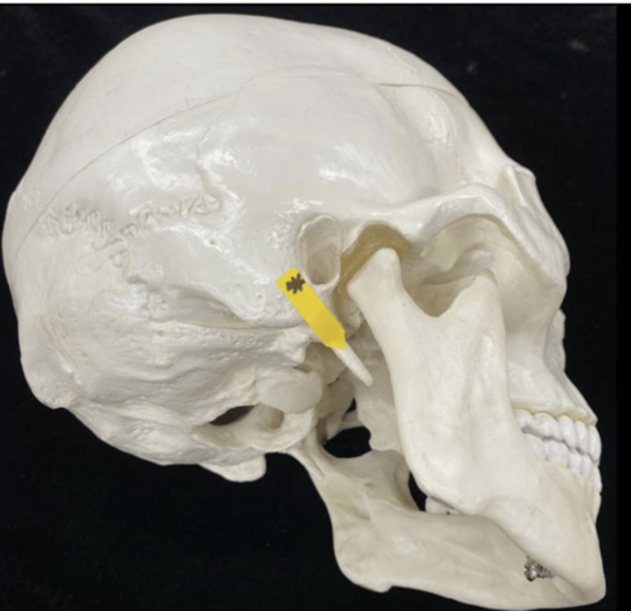 <p>name the bone and bone feature</p>