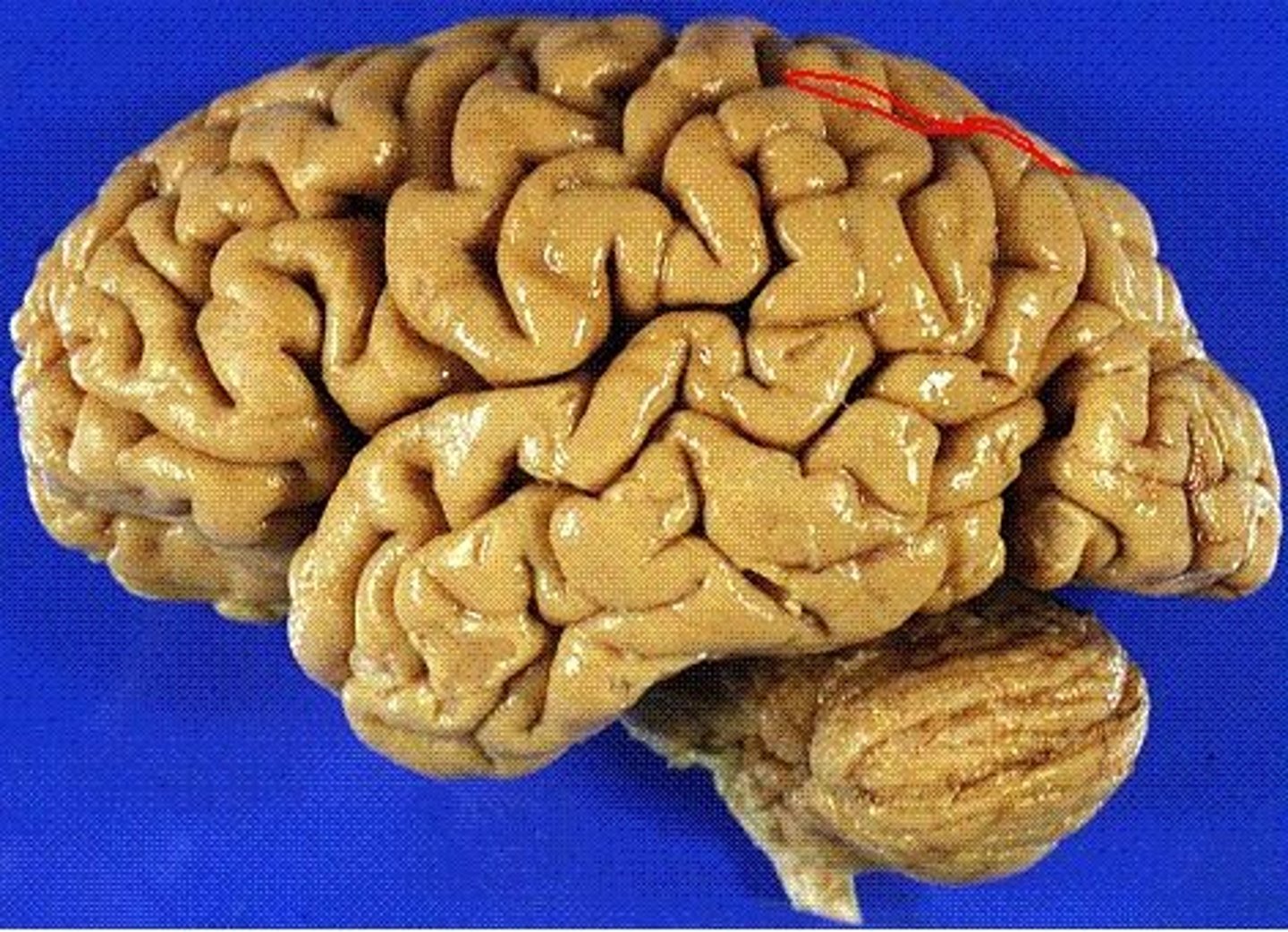<p>Separates superior and inferior parietal lobules</p>