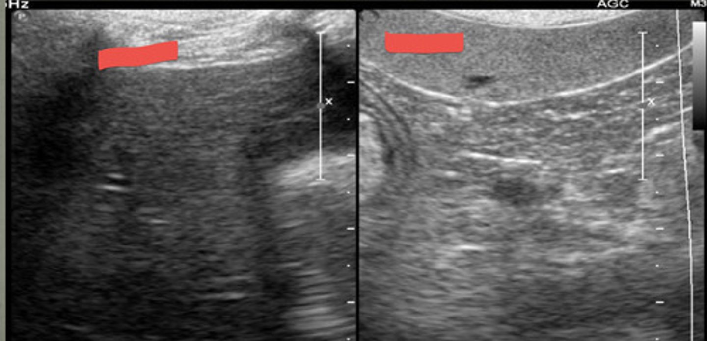 <p>which is the liver and which is the spleen based off of echogenicity?</p>