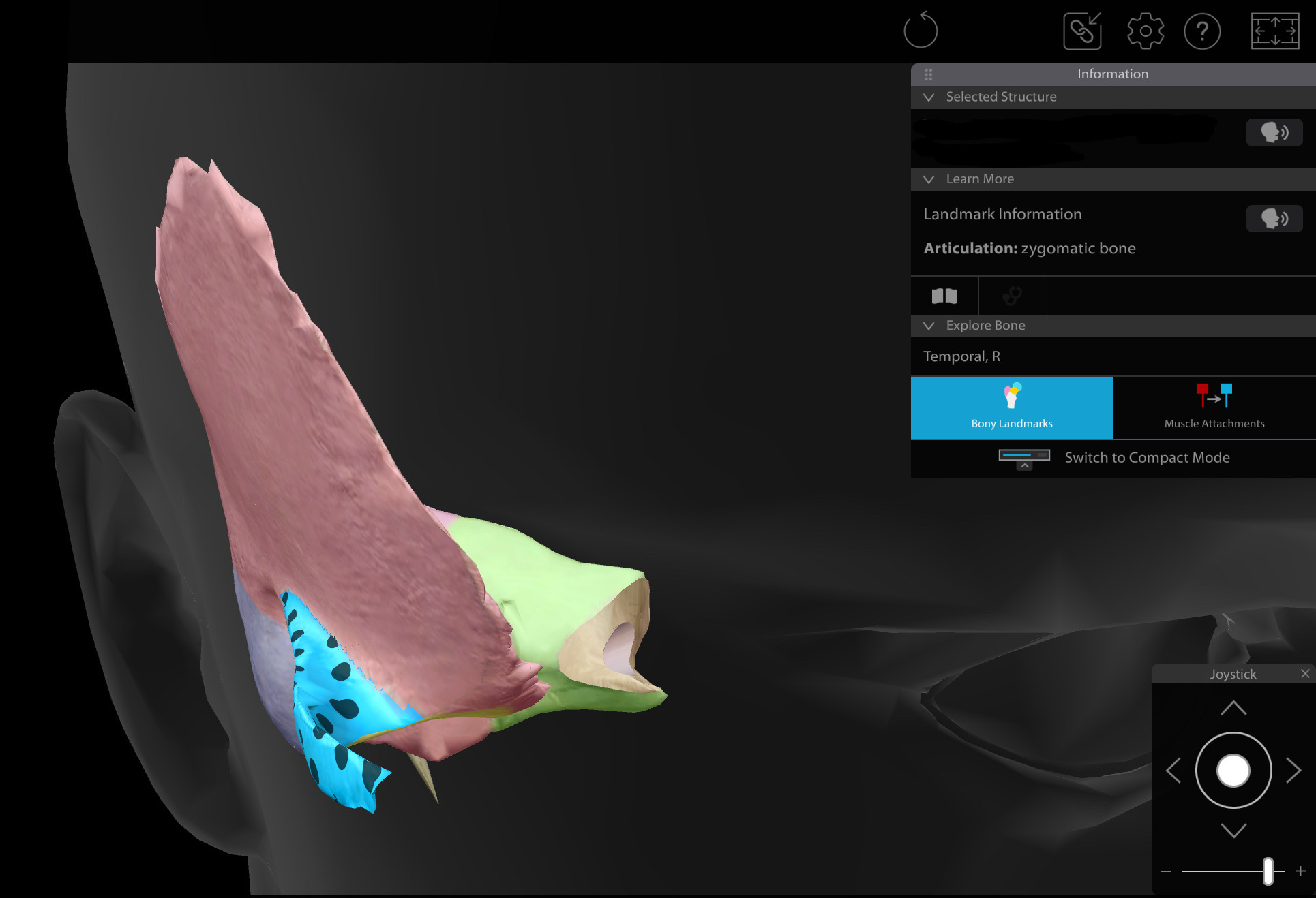 <p>Zygomatic process of the temporal bone, R</p>