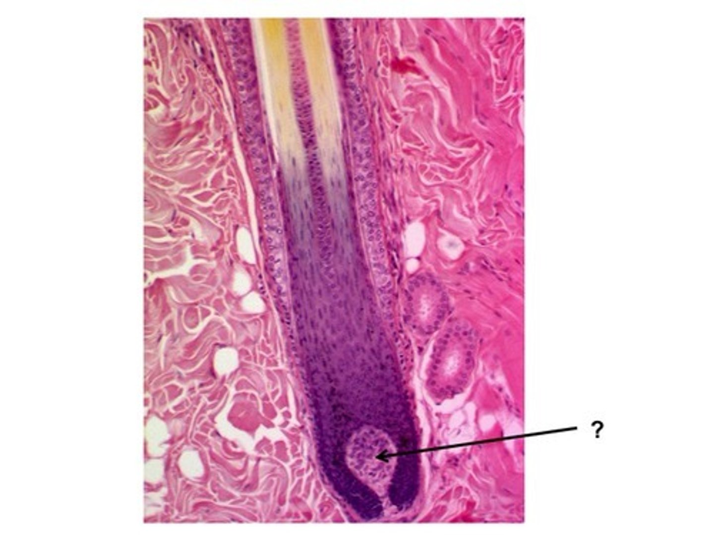 <p>What is this called?</p>