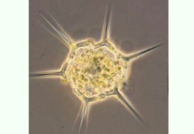 <p>What phytoplankton is this?</p>