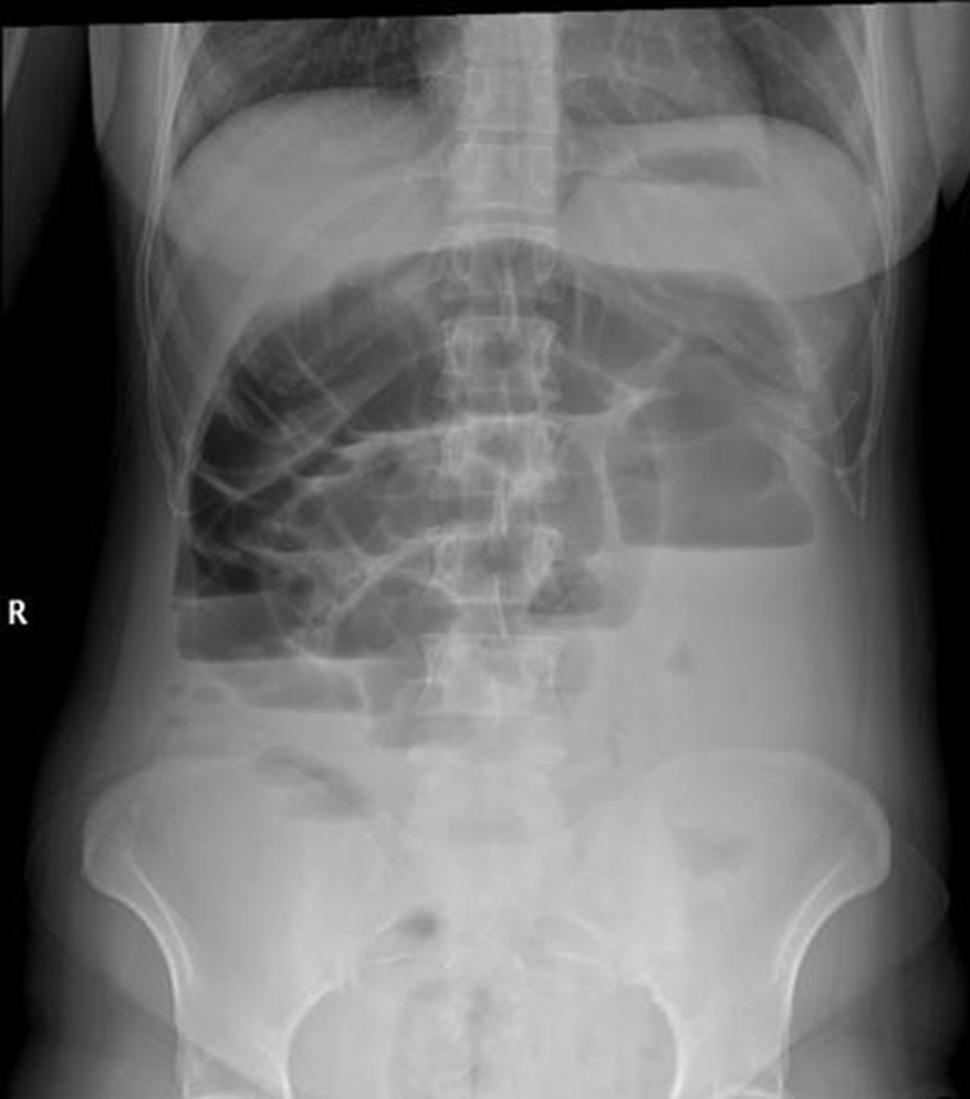 <p>what is this an image of?</p>