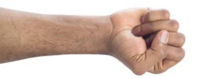 <p>inability to actively flex the DIP joint </p>