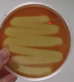 <p>Clear around the colony due to the complete destruction of RBCs; pathogenic</p>