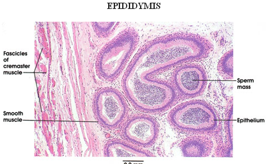<p class=""><strong>Epididymis</strong></p><ul><li><p class=""><strong>Long, coiled duct</strong> with a <strong>regular, round lumen</strong></p></li><li><p class=""><strong>Cytoplasm has no nuclei in it (unlike seminif. tubules)</strong></p></li><li><p class="">Lined by <strong>pseudostratified columnar epithelium</strong> with <strong>stereocilia</strong></p></li><li><p class="">Surrounded by <strong>smooth muscle</strong></p></li><li><p class=""><strong>Sperm</strong> often visible in the lumen</p></li></ul><p class=""></p><p></p>