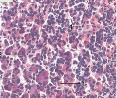 <p>Largest part of pituitary gland- many cell types</p><p></p><p>–<strong>Chromophils and Chromophobes</strong></p><p>Chromophils (Acidophils and Basophils)</p><p>• <strong>Acidophils </strong>(1) Cells that contain the polypeptide hormones-will stain red or orange</p><p>• Somatotrophs</p><ul><li><p>Growth hormone (GH)</p></li><li><p>somatotropin</p></li></ul><p></p><p>• Lactotrophs</p><ul><li><p>Prolactin (PRL)</p></li></ul><p></p>