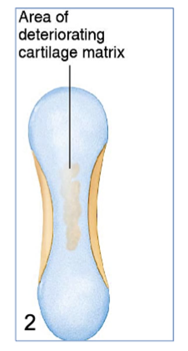 <p>2) The bony collar reduces blood flow to the inside of the cartilage, cutting off nutrients to the chondrocytes, causing them to break down.</p>