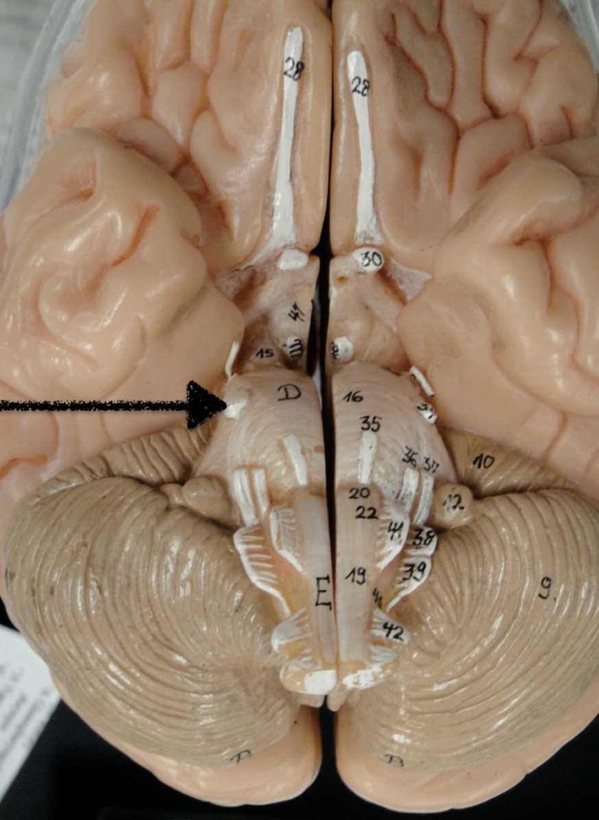 <p>name this cranial nerve</p>