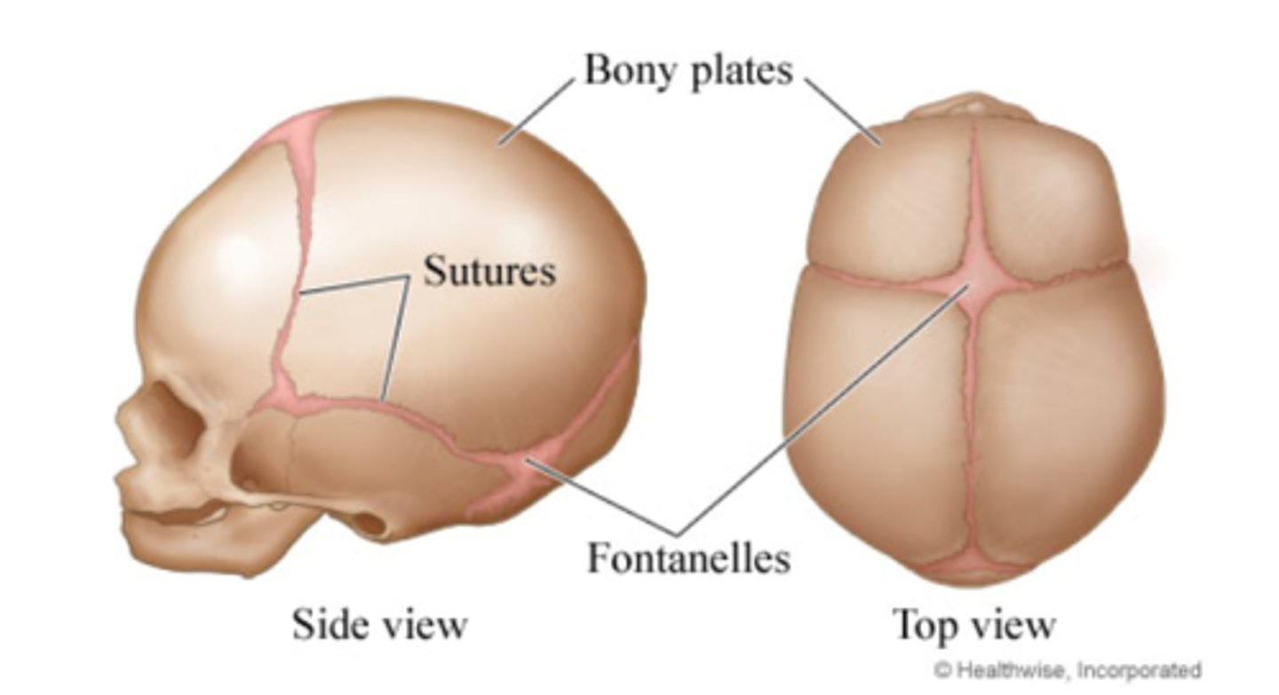 <p>A malformation of the skull due to the premature closure of the cranial sutures.</p>