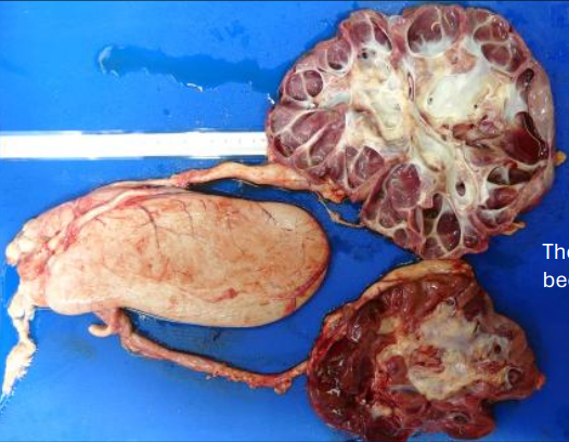 <p>What has been done to these kidneys?</p>