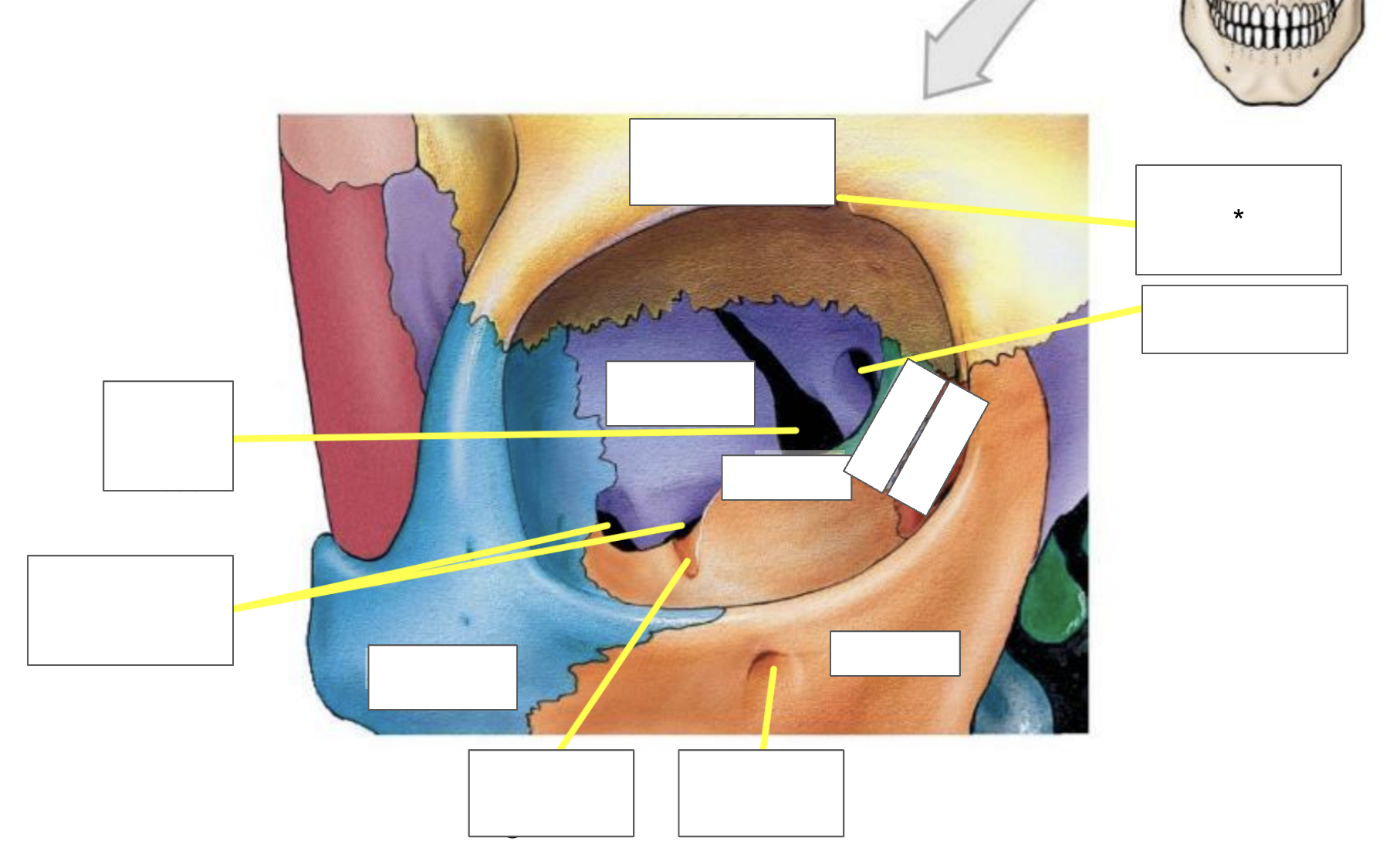 term image