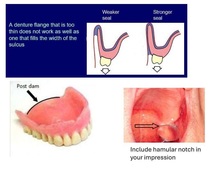 <p>the denture on the right has a better seal&nbsp;</p><p>air cannot pass up the sulcus and into the denture, this can cause the denture to dislodge</p><p>a denture flange that is too thin does not work as well as one that fills the width of the sulcus&nbsp;</p><p>the post dam - in between the hamular notch- you scrape a m shape at the back so more material goes in for extra support at the back as here is no sulcus posteriorly, this digs in the vibrating line area at the back of the mouth where the tissue is more compliant&nbsp;</p>
