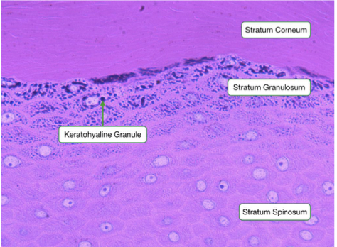 <p>“corny layer”</p><ul><li><p><mark data-color="yellow">corneocytes</mark></p></li><li><p>Many layers (25+)</p></li><li><p>Brick-and-mortar architecture</p><ul><li><p>bricks of keratin</p></li><li><p>lipids form the mortar (cement)</p></li></ul></li></ul>