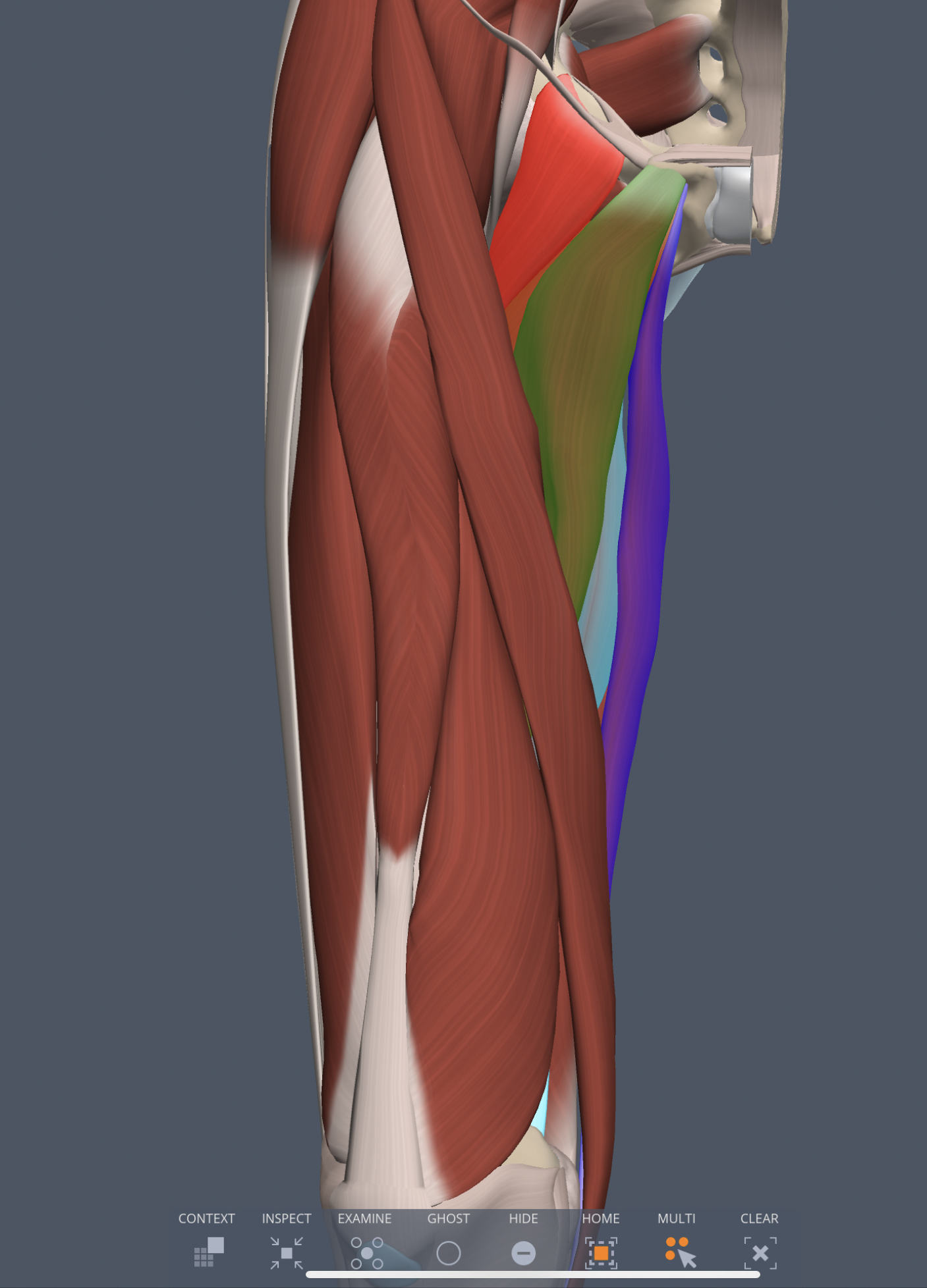 gracilis (medial thigh) origin
