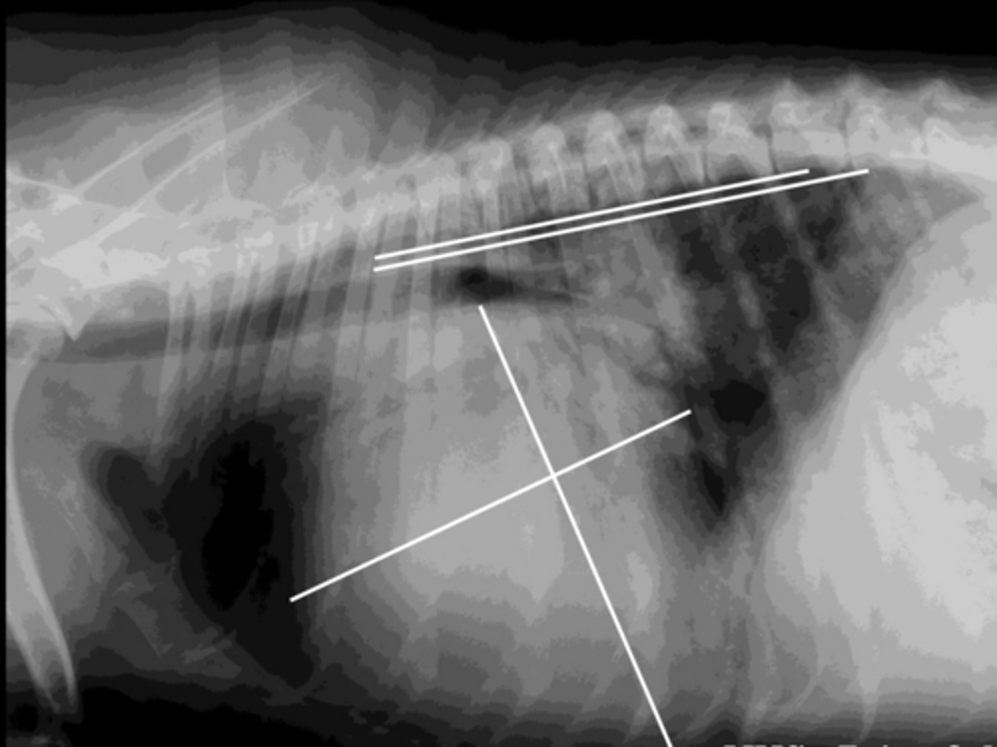 <p>Given the following rad what is the DX?</p>