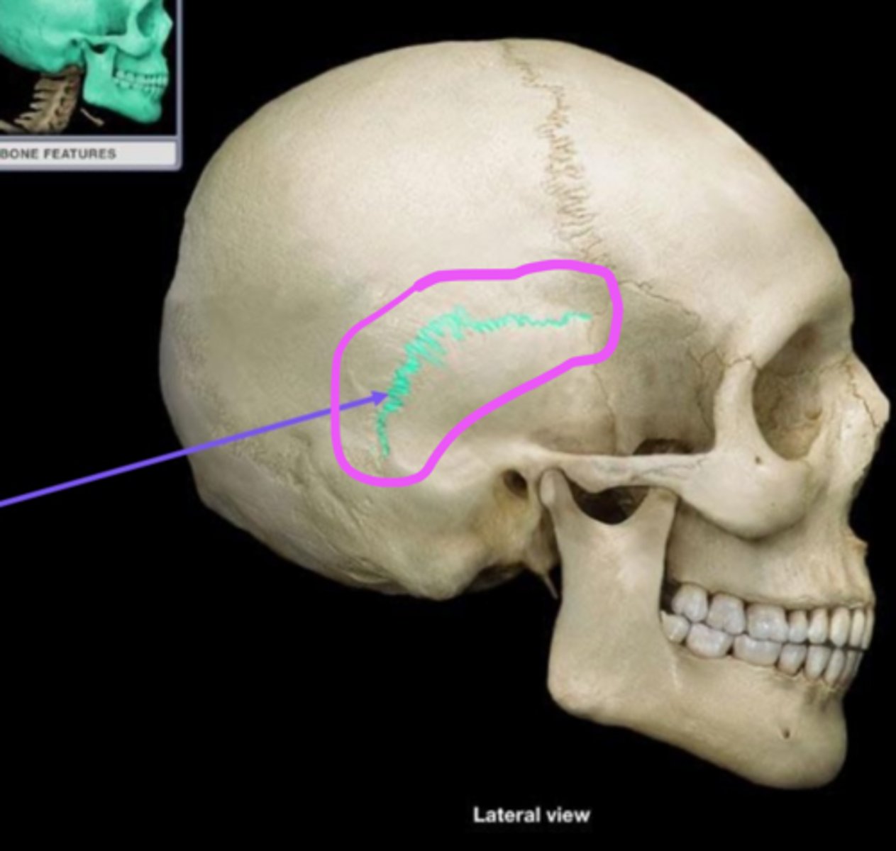 knowt flashcard image