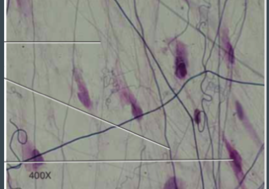 <p>(connective) looks like loosely organized fibers</p>