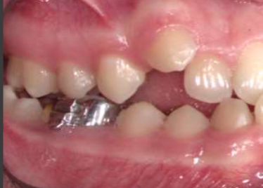 <p>classification?</p>