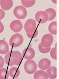 <p>Identify the blood cell</p>
