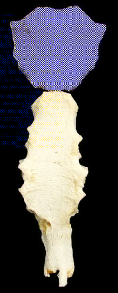 <p>Articulates with 1st rib and clavicle</p>