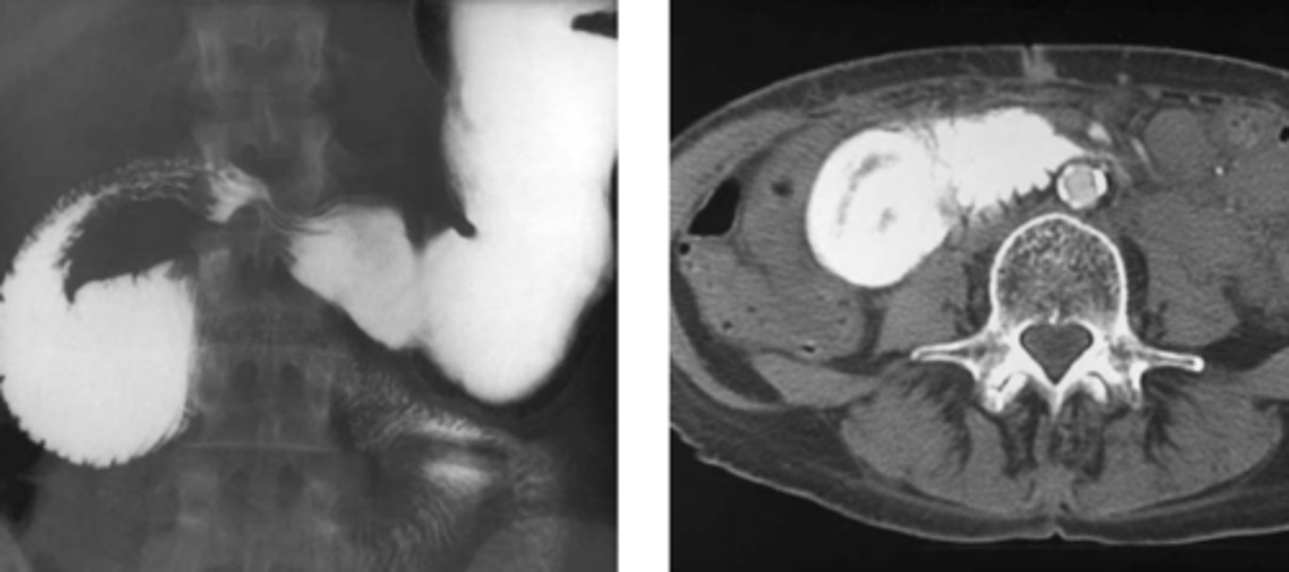 <p><em>identify the pathology</em></p>