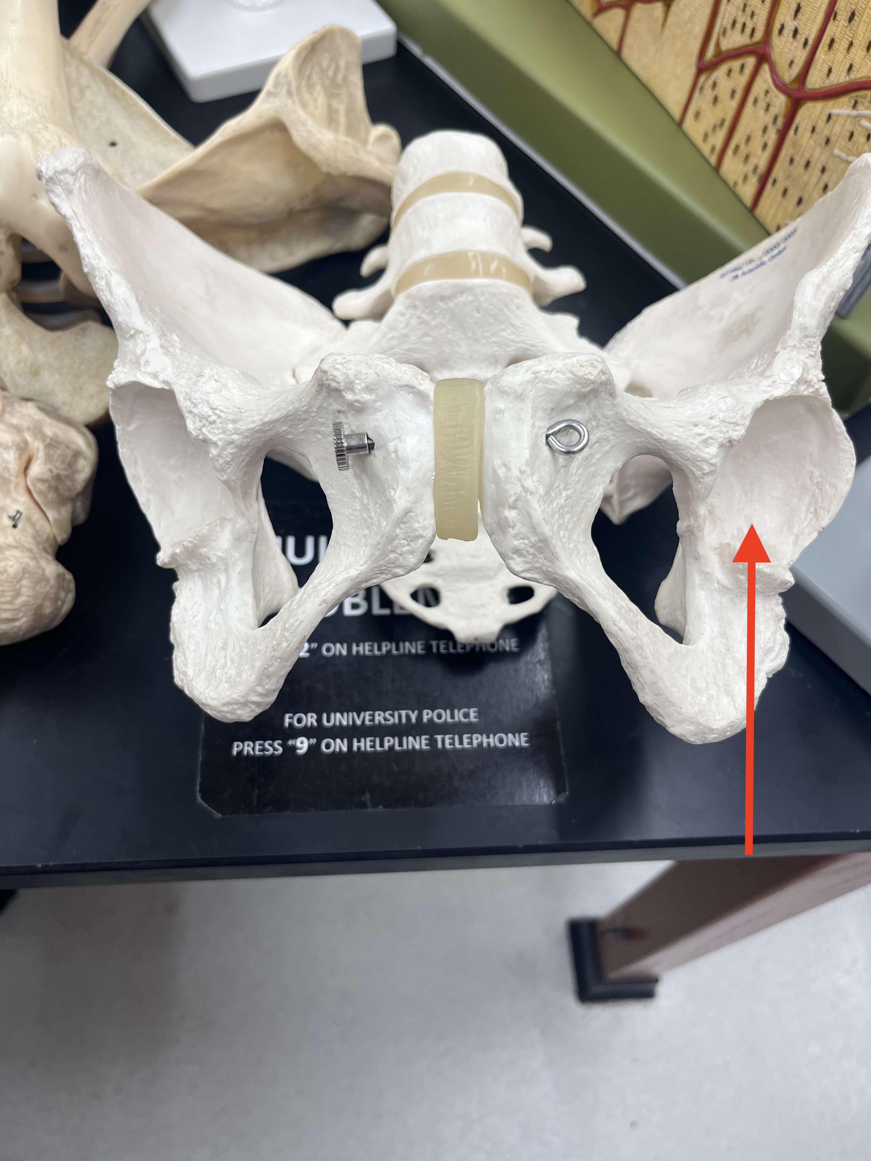 term image