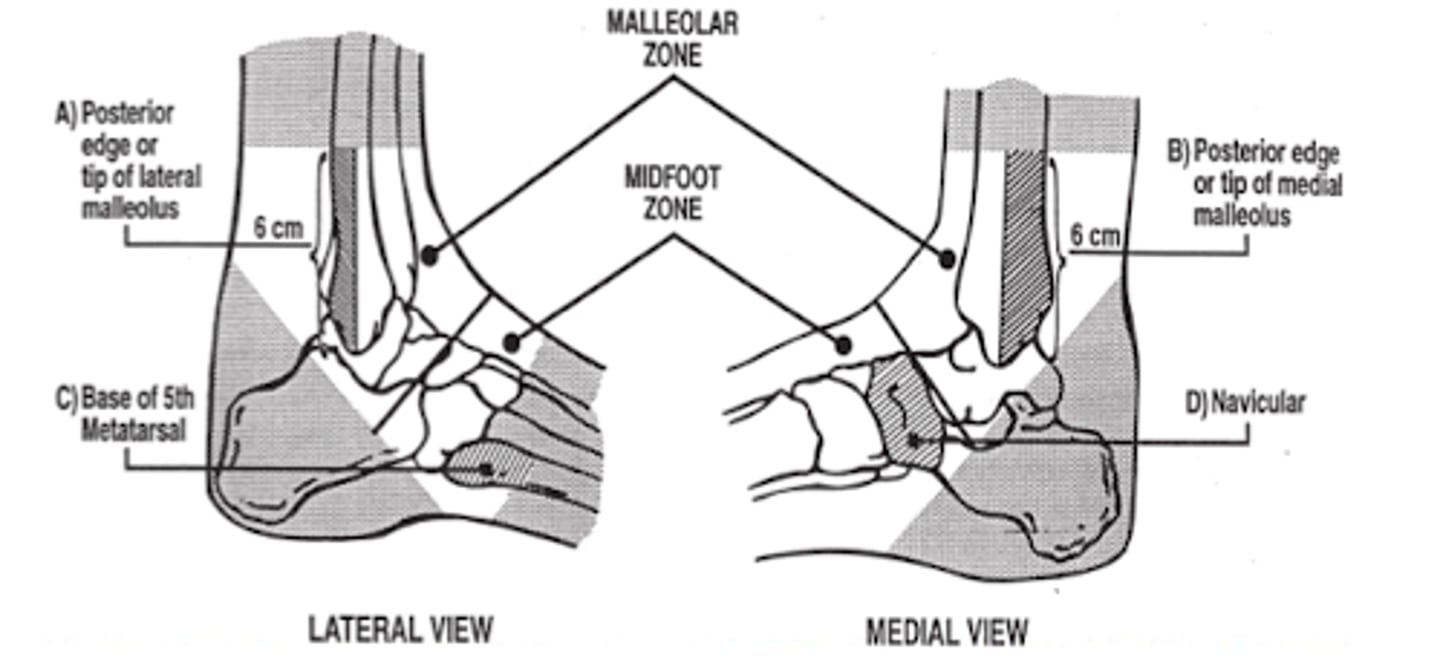 <p>ONLY if there is pain in the mid-foot region and any of the following:</p><p>(C)</p><p>or </p><p>(D)</p><p>or </p><p>- inability to wear weight</p>