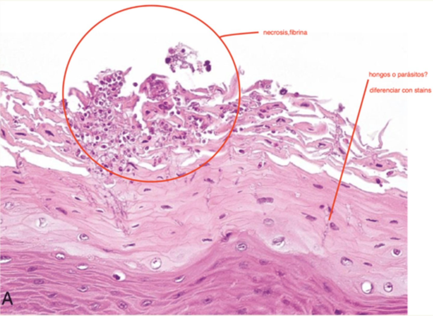 <p>muestra de la lengua.</p><p>¿diagnóstico?</p>