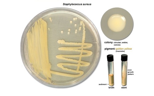 <p>Say the following about Staphylococcus epidermidis&nbsp;</p><p>Growth Medium: &nbsp;</p><p>Pigment: </p><p>is it diffusible: </p><p>Oxygen characteristics:</p>