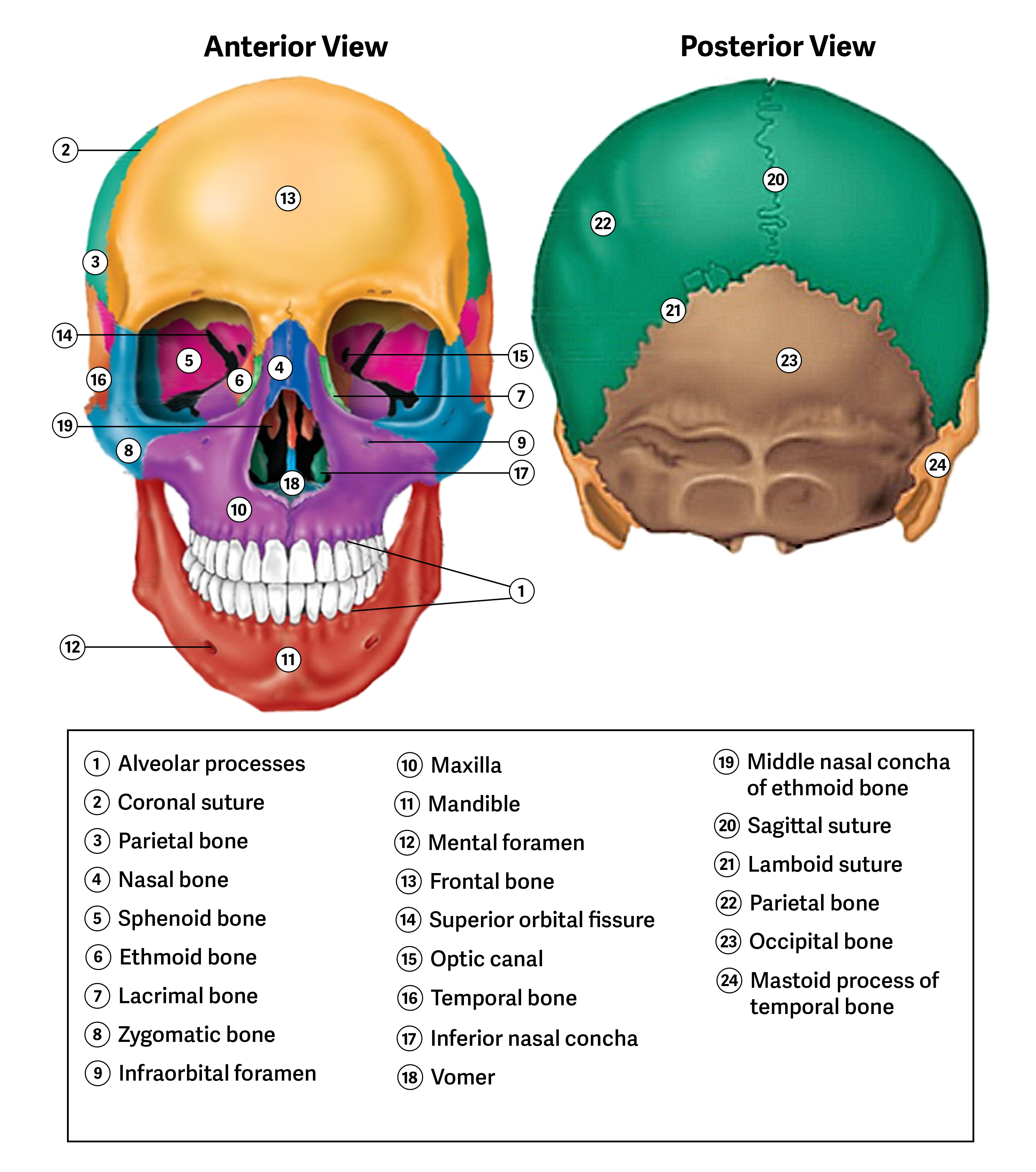 <p><span><span>At some sutures, the connective tissue will ossify and be converted into bone, causing the adjacent bones to completely fuse to each other. Fusion between bones is called </span><strong><span>synostosis</span></strong><span>,</span></span><strong> </strong><span><span>which means “joined by bone”.&nbsp;</span></span></p><p><span><span> Examples of synostosis fusions between cranial bones are found both early and late in life. </span></span></p><p></p><p><span><span>At the time of birth, the frontal and maxillary bones consist of right and left halves joined together by sutures, which disappear by the eighth year as the halves fuse together to form a single bone. </span></span></p><p></p><p><span><span>Late in life, the </span><strong><span>sagittal</span></strong></span><strong>, </strong><span><strong><span>coronal</span></strong></span><strong>, </strong><span><span>and</span></span><strong> </strong><span><strong><span>lambdoid sutures</span></strong><span> </span></span><strong>(Figure 4.11) </strong><span><span>of the skull begin to ossify and fuse, causing the suture line to gradually disappear.</span></span></p>