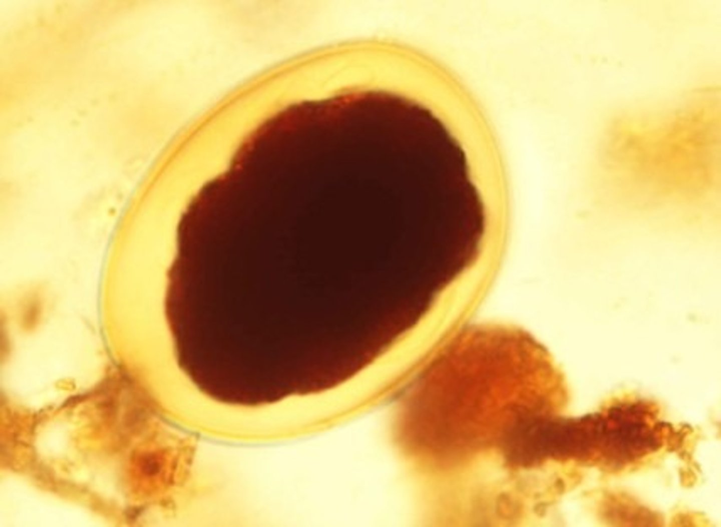 <p>Identify the parasite</p>