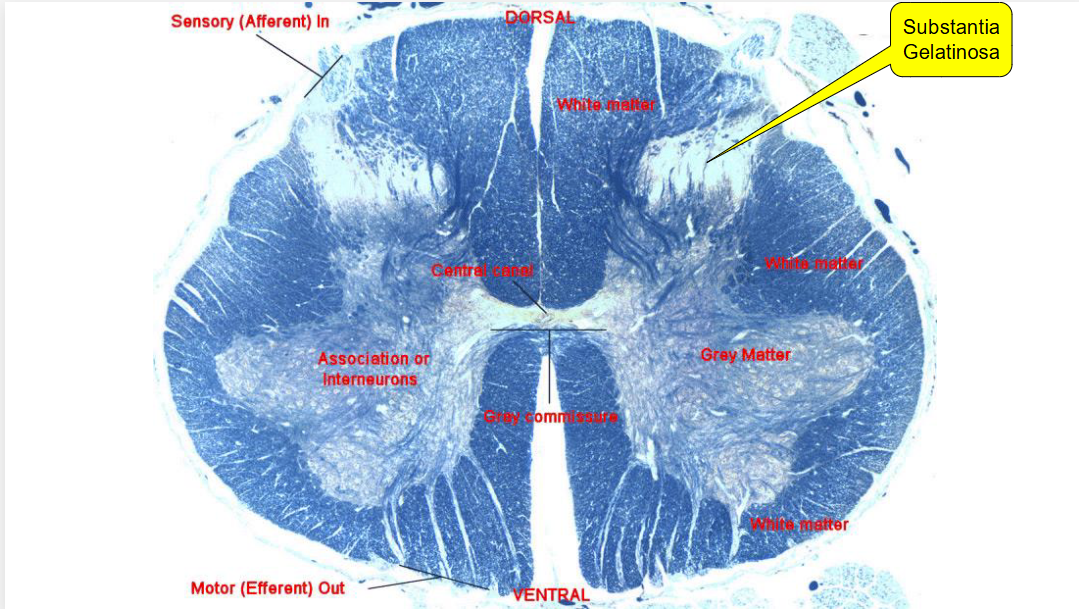 <p>Grey matter region (cell bodies) in the dorsal spinal cord, capping the dorsal horn. Important in pain, temp, and touch sensations. <br><br>First-order somatosensory neurons start AP at the axons. This AP then travels to the cell bodies in this region, which initiate first synapse of the spinothalamic tract.</p>